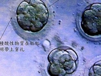 rh血型能做试管婴儿吗(三代试管婴儿能阻断镰刀型细胞贫血遗传吗)