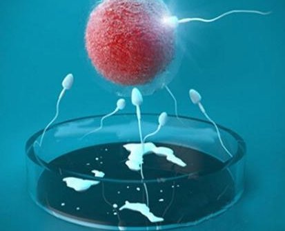 2026年未婚开普敦做三代试管的成功率有多高？该如何做试管